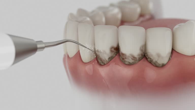 Reliable Dental contractor in Cresson, PA by Dentist Open Now